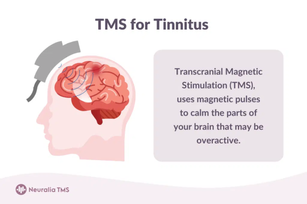 Neuralia TMS Rolls Out New Tinnitus Treatment Options in Melbourne