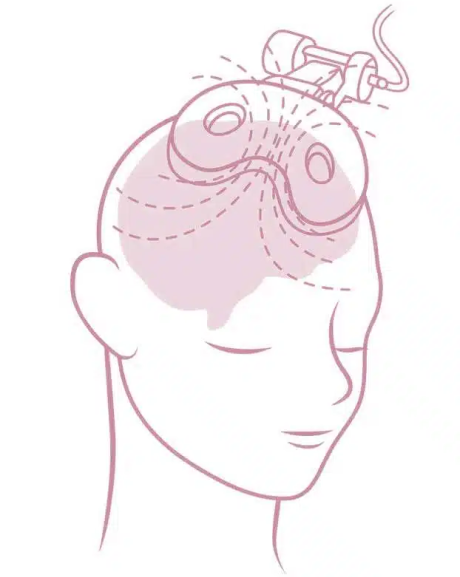 Neuralia TMS Opens TMS Clinic in Kardinya as Demand for Mental Health Solutions Grows