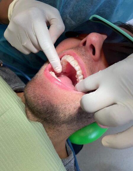Totalcare Dental and Dermal Explores Cosmetic Dentistry Trends for Patients in Bondi Junction