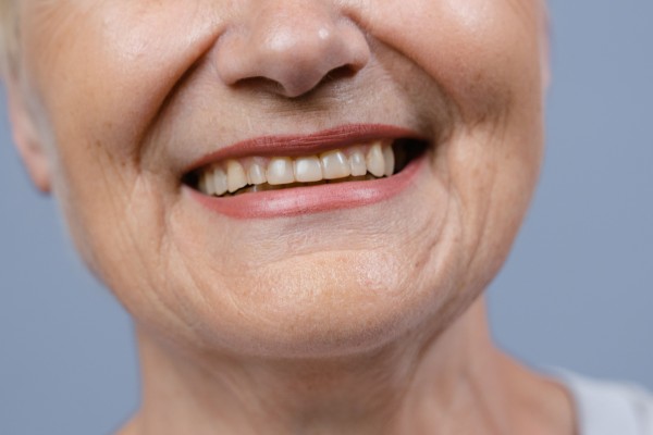 Infinity Smiles Releases Medicare Dental Checklist for NY Seniors Ahead of Dec. 7 Deadline